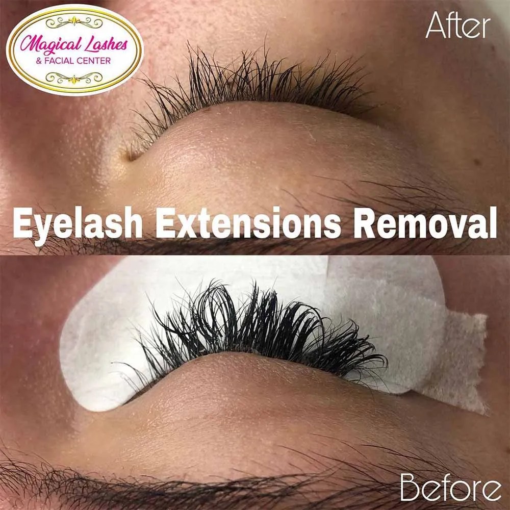 Removing Eyelash Extensions When and How to Do That?