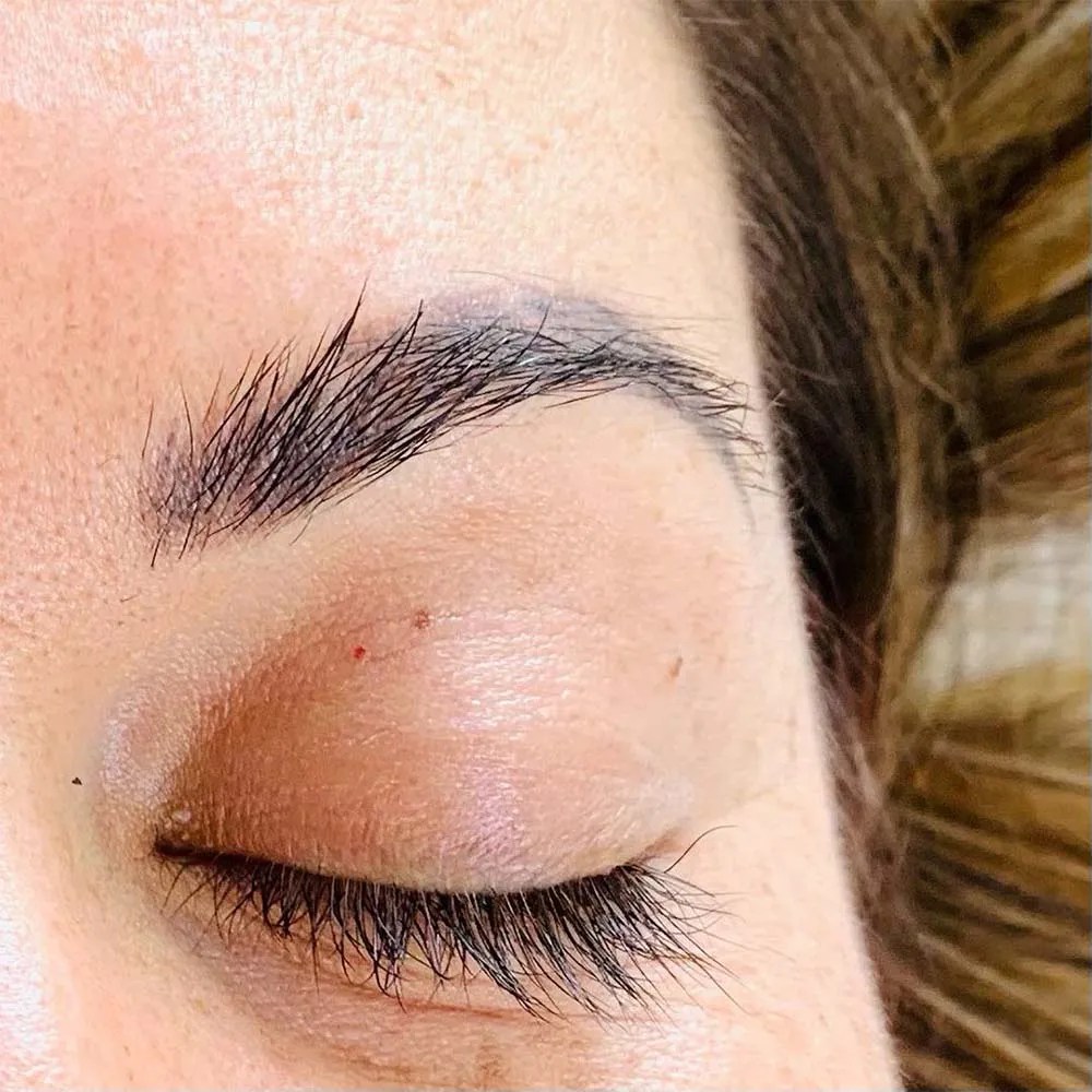 How to Get Rid of Microblading Immediately After and Years Later