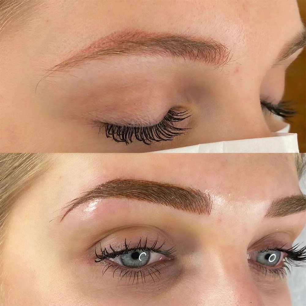 Fixing Bad Microblading When to Correct and When to Remove