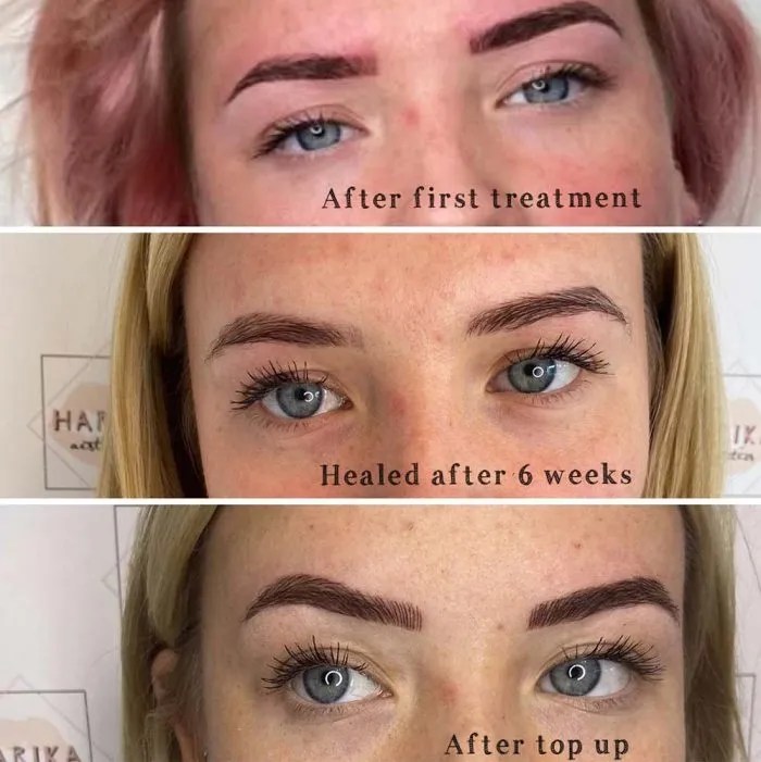Microblading Recovery Stages, Pain, Aftercare, Longevity