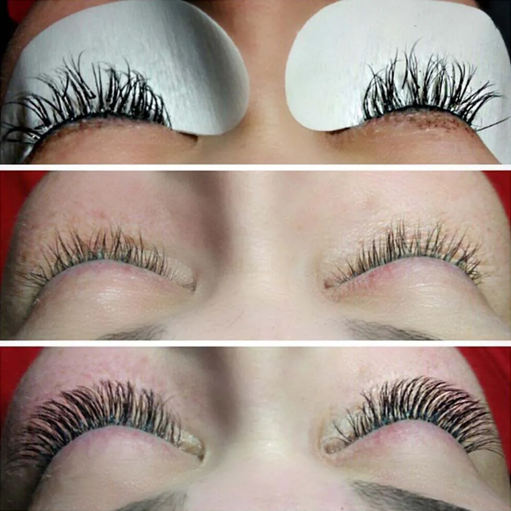 Eyelash Extension Damage