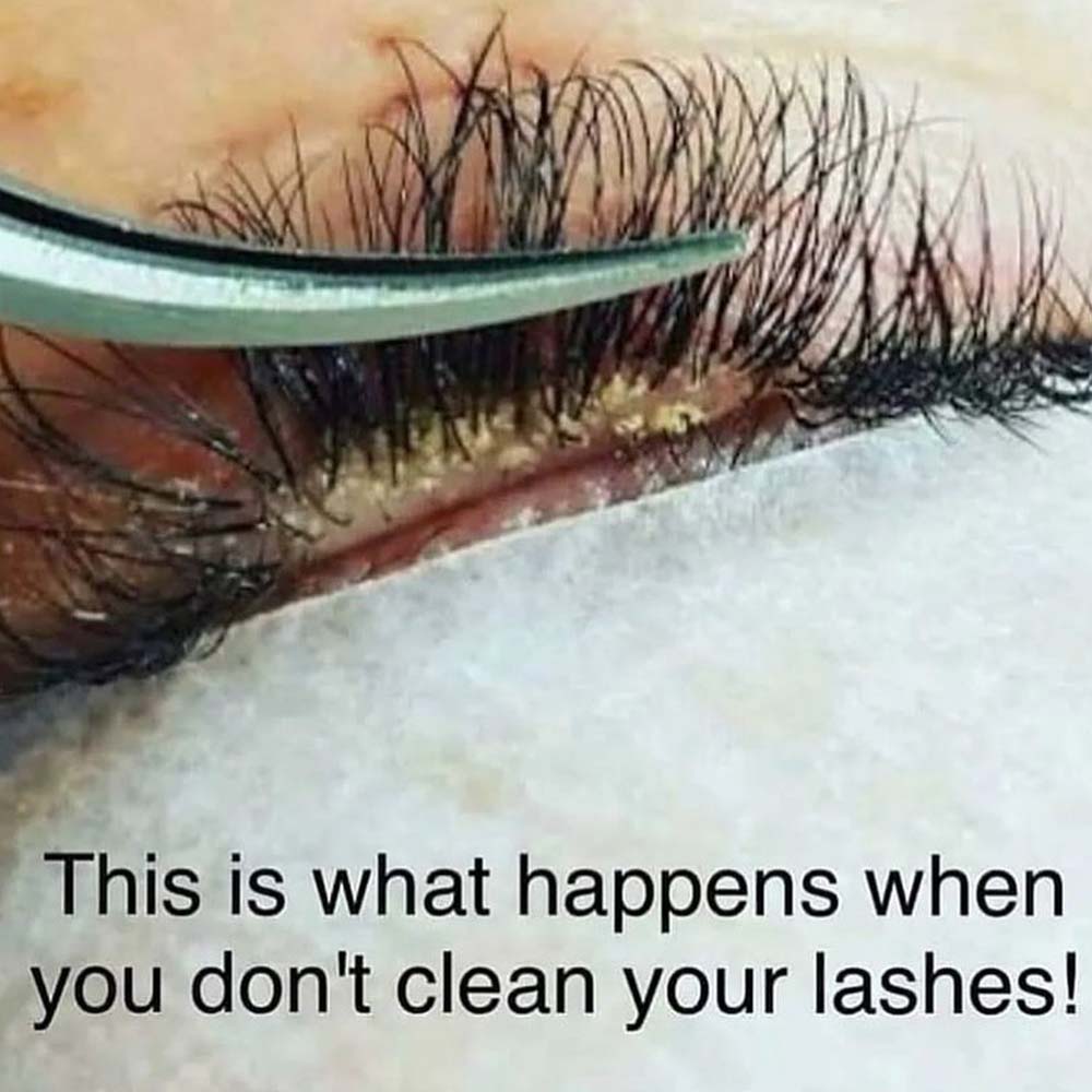 Can You Get Lash Mites on Lash Extensions + What to Do