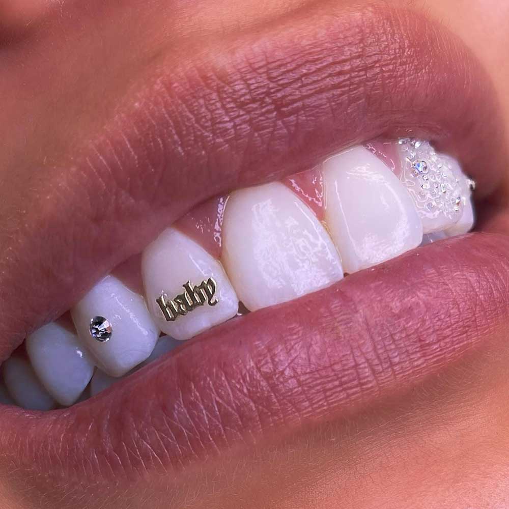 How Much Do Tooth Gems Cost US, UK, Canada, Australia