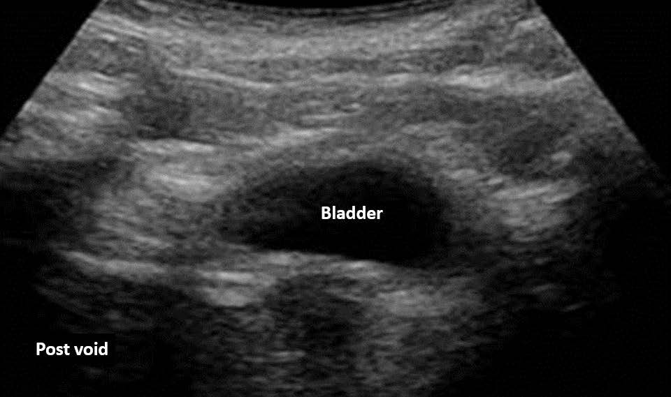 Case Study Colicky Pain Case Studies
