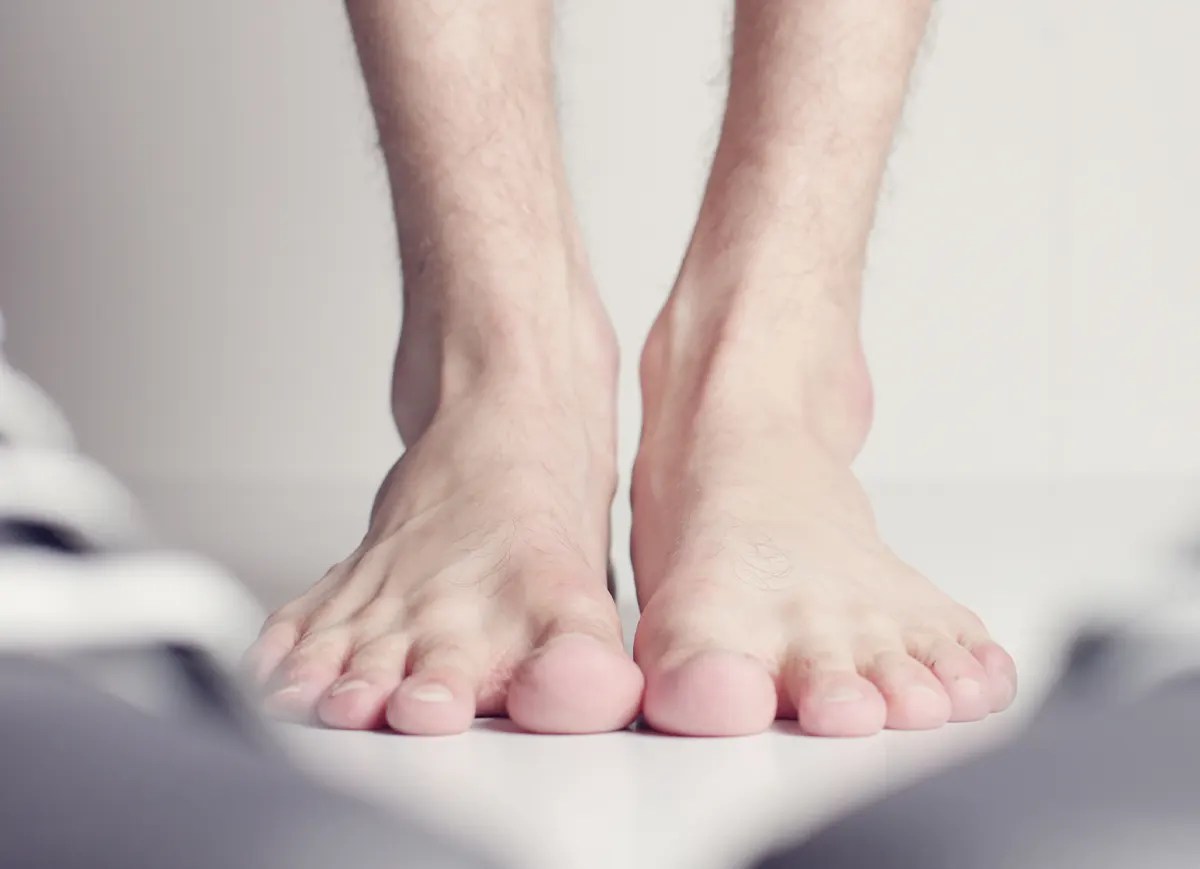 Top 126+ sandal gap deformity causes vietkidsiq.edu.vn