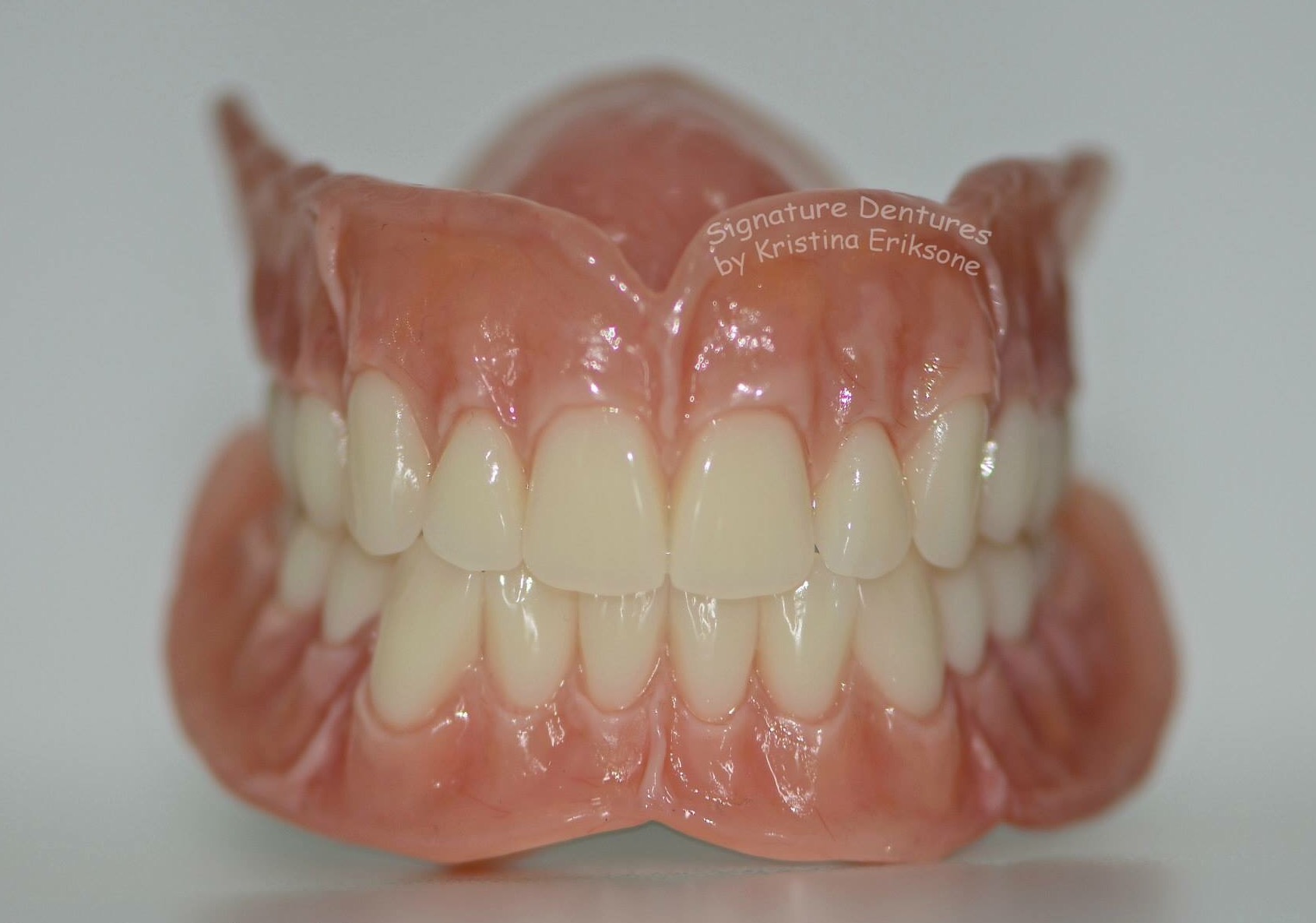 What Are The Best Natural Looking Dentures Prosthodontic Services
