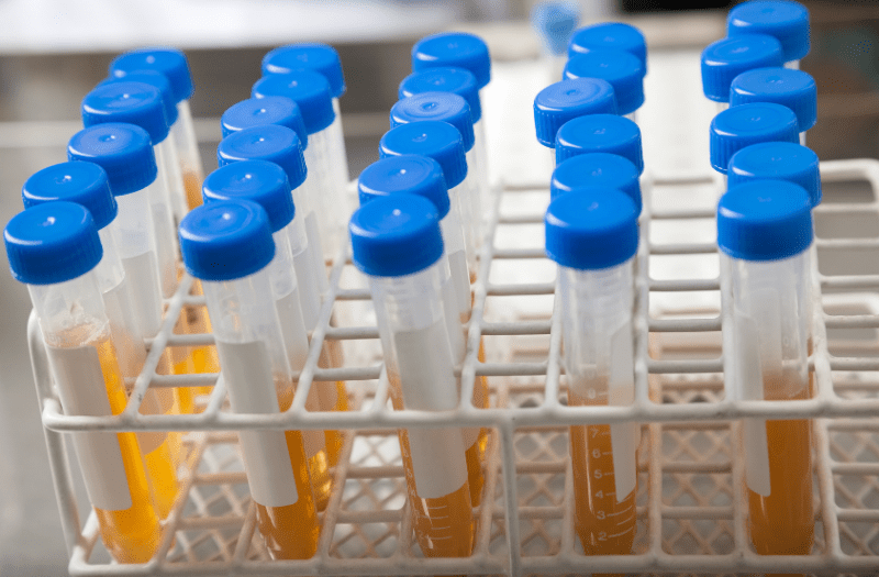 New OpenSource Test Tube Rack Helps COVID19 Testing Lab Tame