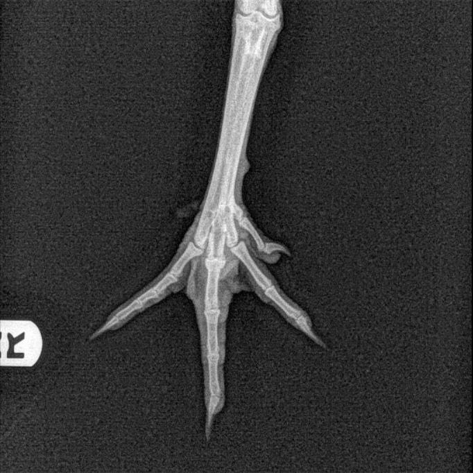 Checker's Fractured Foot