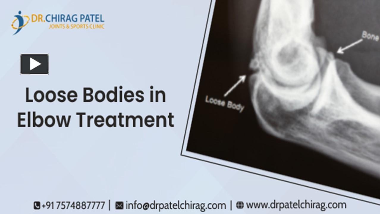 PPT Loose Bodies Removing From the Joint Surgery Elbow Arthroscopy