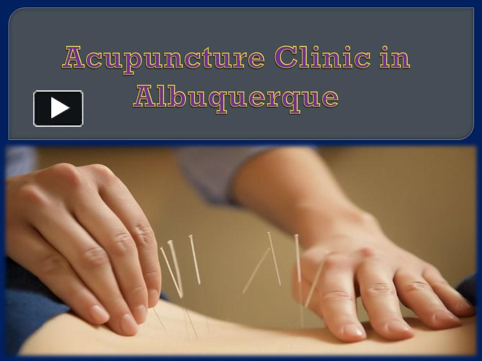 PPT Acupuncture Clinic in Albuquerque PowerPoint presentation free to download id 957ae9