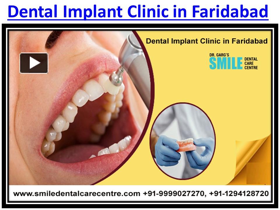 PPT Best Dental Implant Clinic in Faridabad Dental Implants