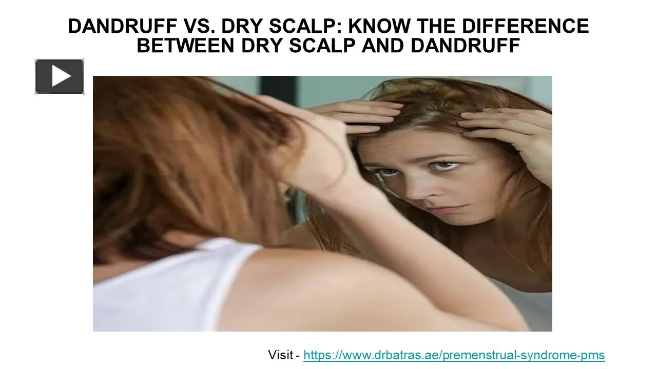 PPT Dandruff vs. Dry Scalp Know the difference between dry scalp and