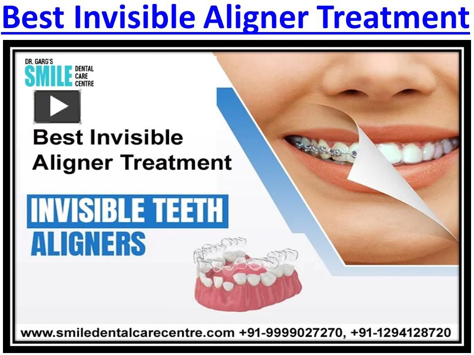 PPT How Do I Get Best Invisible Aligner Treatment And Care It