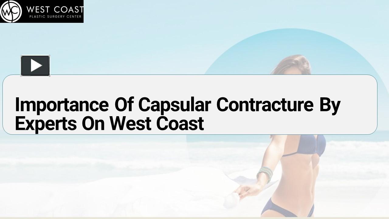 PPT Importance Of Capsular Contracture By Experts On West Coast PowerPoint presentation free