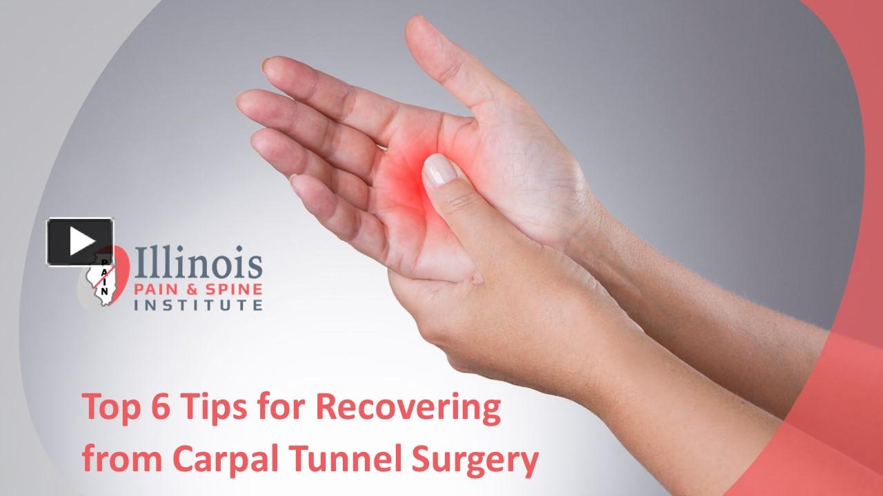 PPT Hand Exercises After Carpal Tunnel Surgery The Ultimate Guide