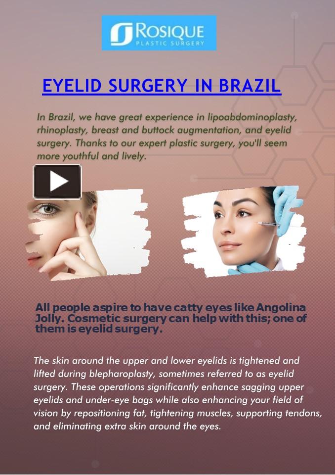 PPT Best Eyelid Surgery in Brazil Rosique Plastic Surgery
