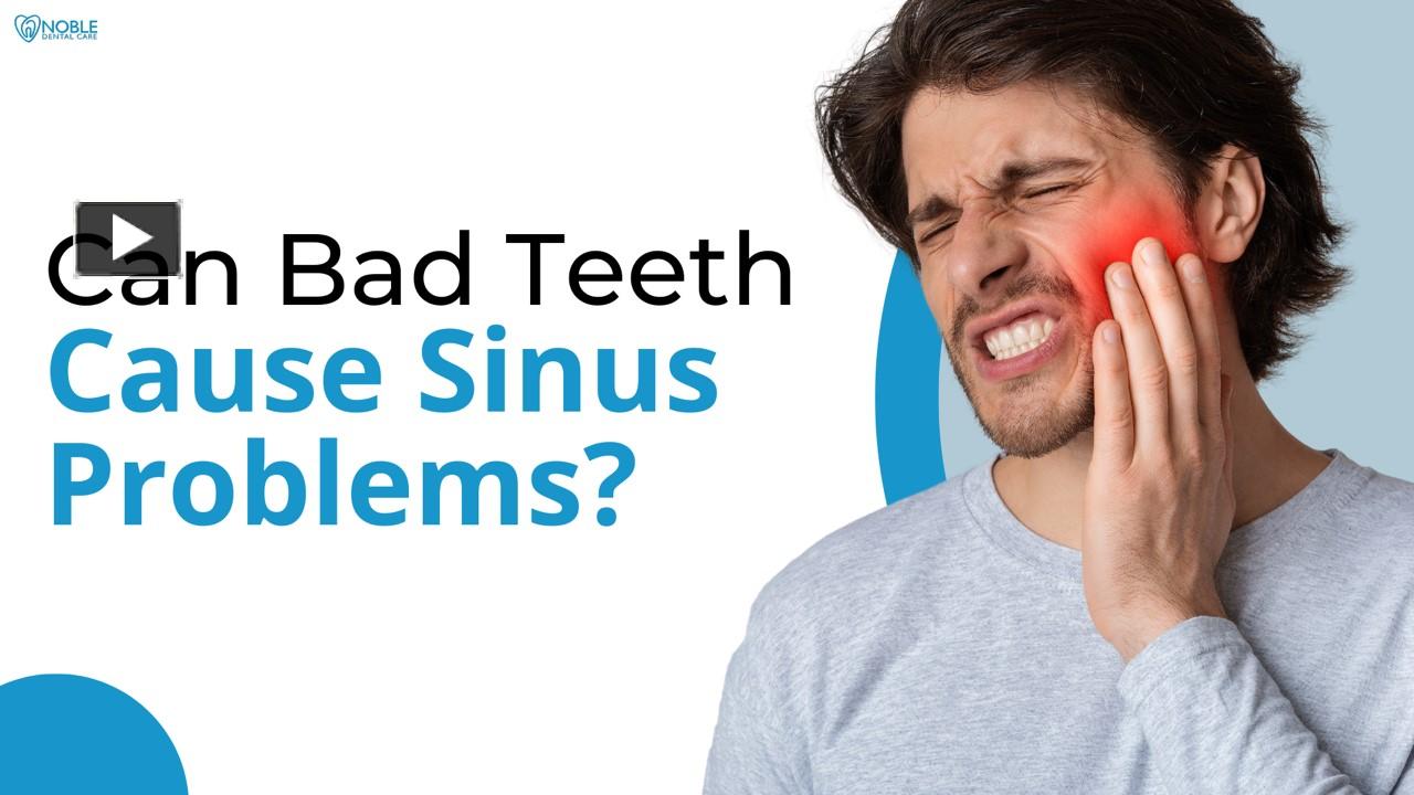 PPT Can Bad Teeth Cause Sinus Problems PowerPoint presentation free