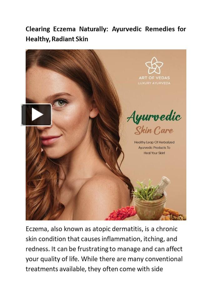 PPT Clearing Eczema Naturally Ayurvedic Remedies for Healthy, Radiant