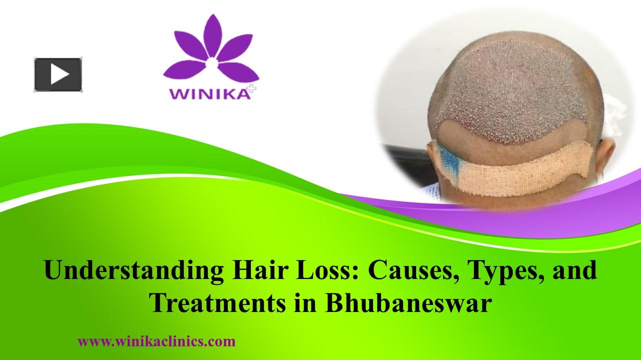 PPT Understanding Hair Loss Causes, Types, and Treatments in