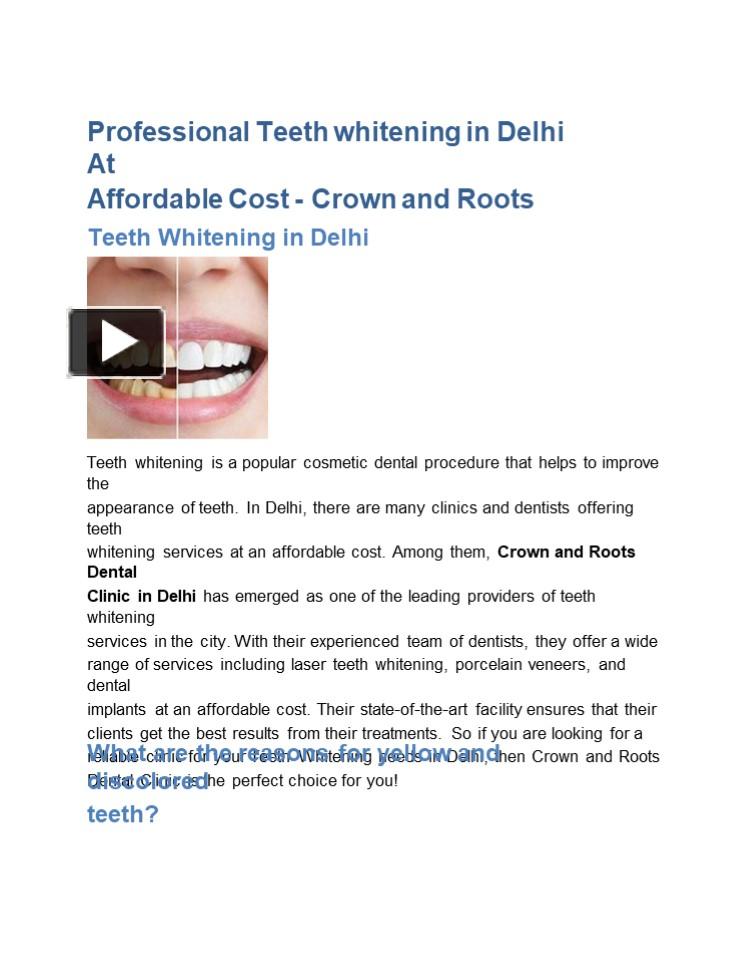 PPT Professional Teeth whitening in Delhi At Affordable Cost Crown