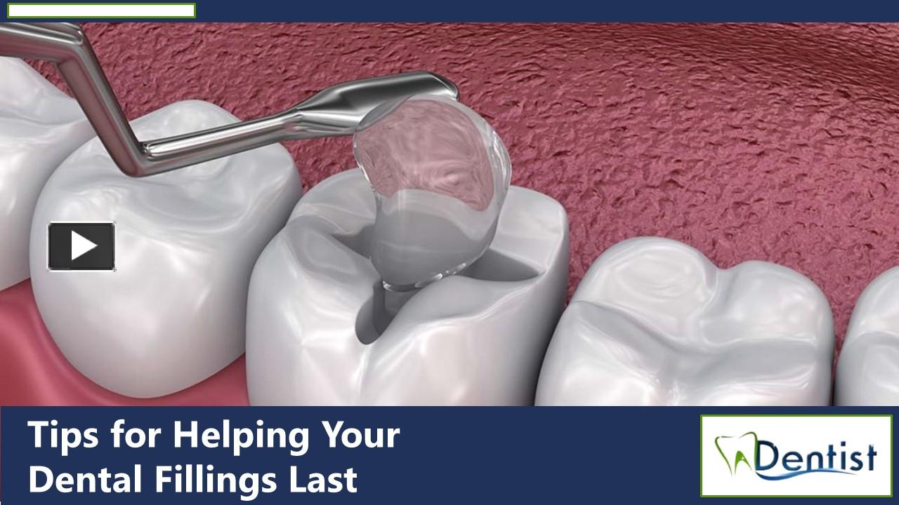 PPT Unveiling the Secrets Dental Fillings How Long Do They Really