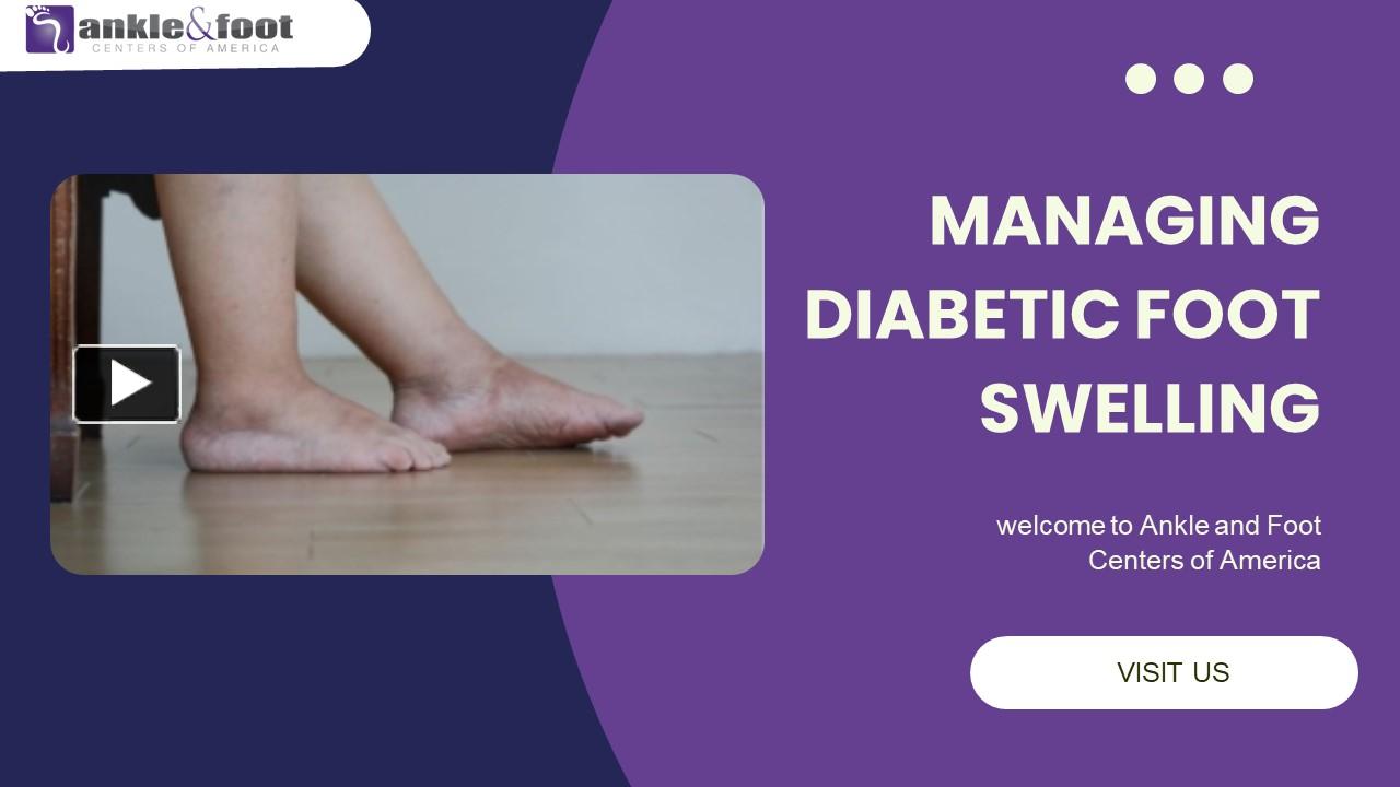 PPT Managing Diabetic Foot Swelling PowerPoint presentation free to