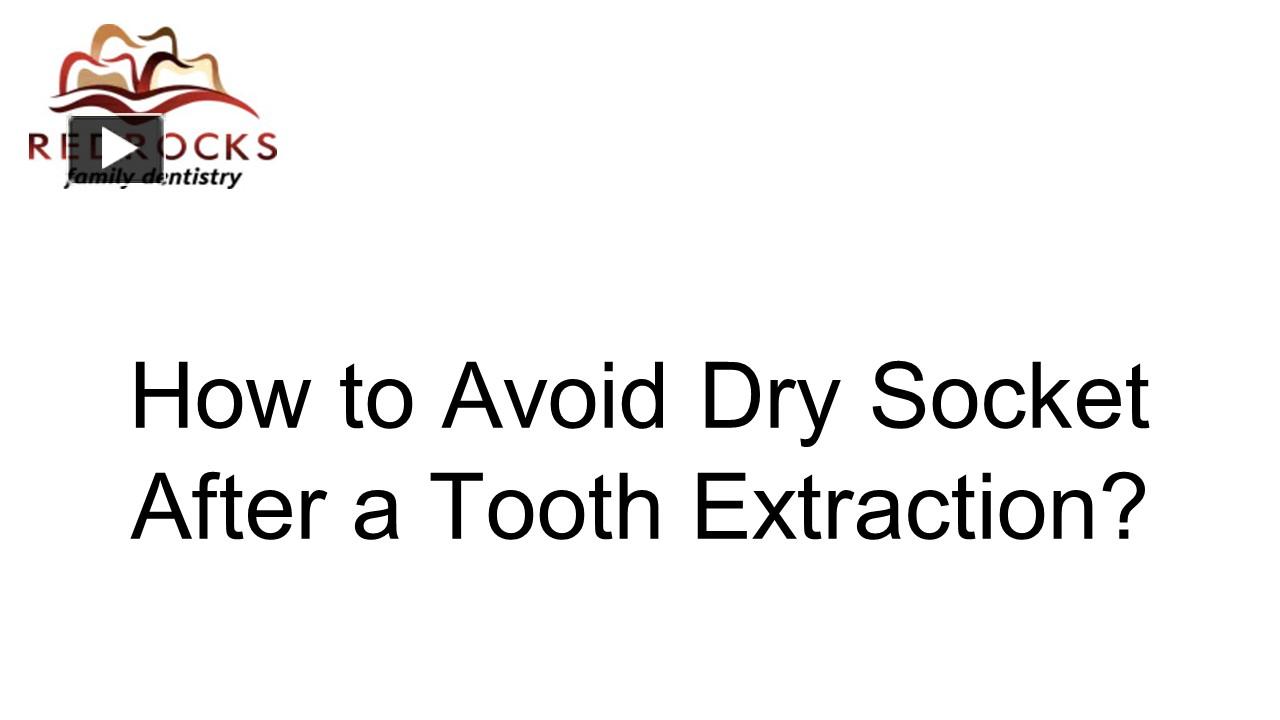 PPT How to Avoid Dry Socket After a Tooth Extraction Red Rocks