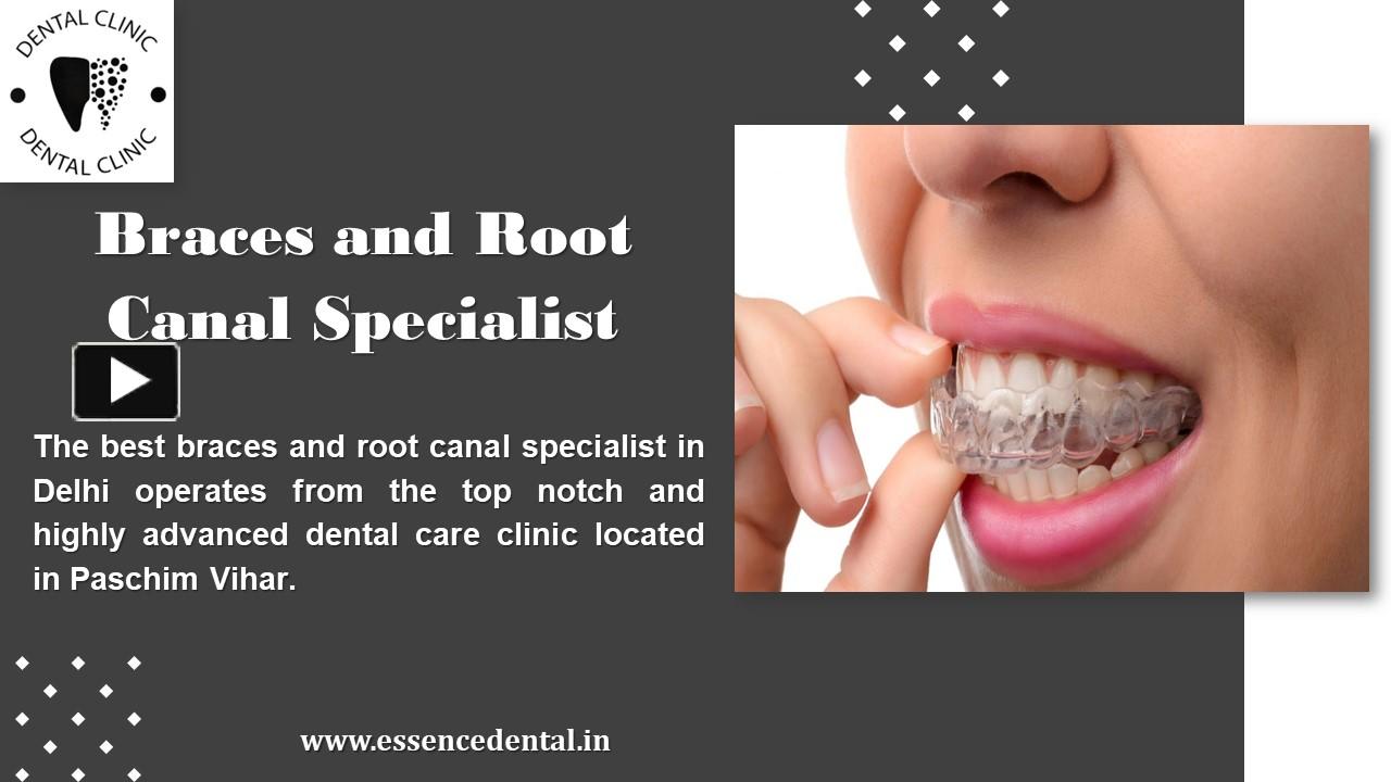 PPT Braces and root canal specialist PowerPoint presentation free