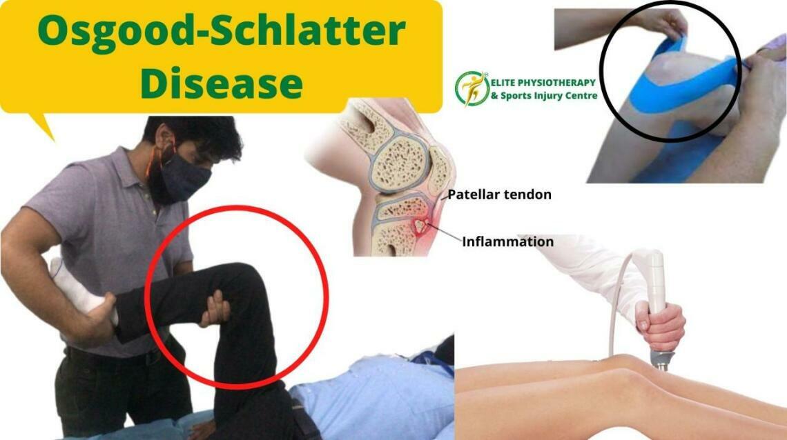 OsgoodSchlatter Disease