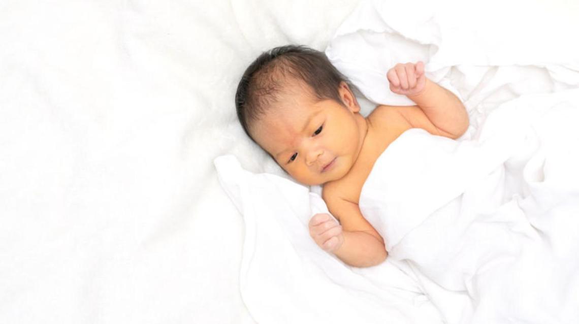 Jaundice in Babies What You Need to Know