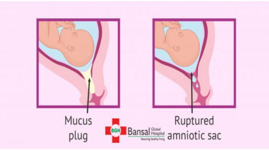 87 Awesome Pouch Of Douglas Pain Ovulation insectza