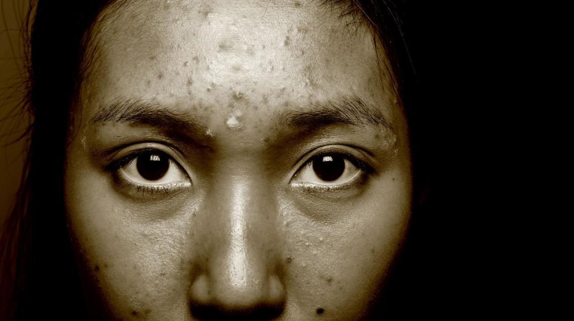 Is Lead Turning Your Face Black?