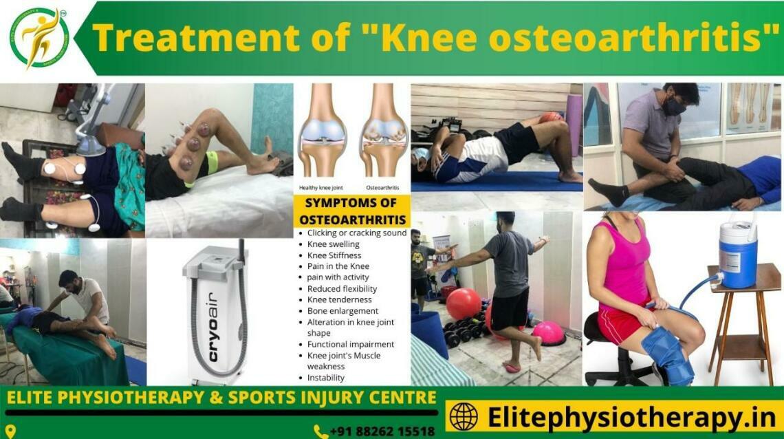 Treatment of Knee Osteoarthritis