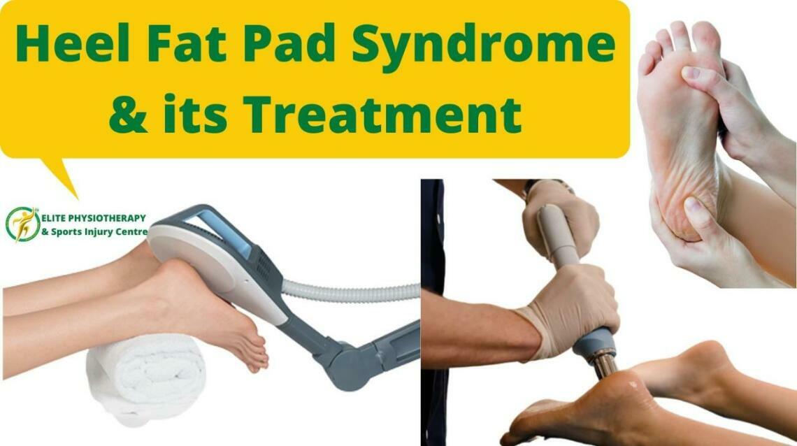 Heel Fat Pad Syndrome & Its Treatment