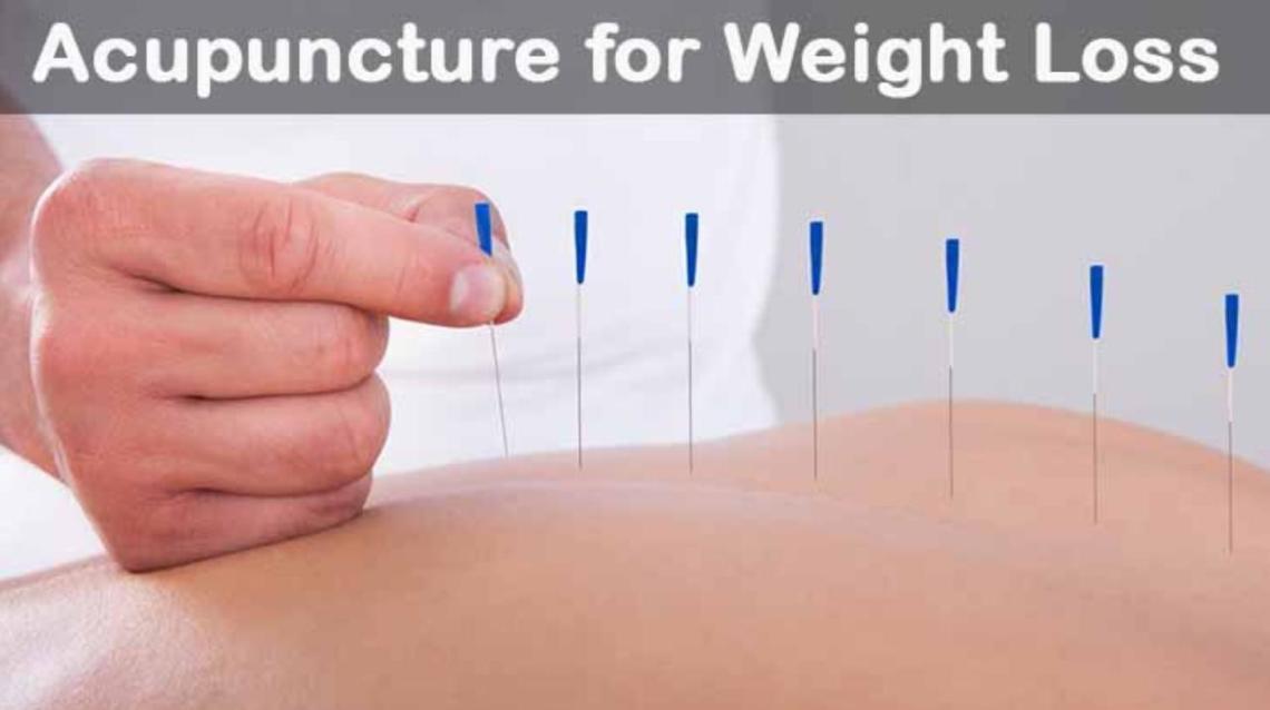 6 Ways by Which Acupuncture Helps to Reduce Weight