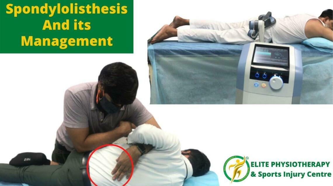 What Is Spondylolisthesis? Symptoms, Causes and Treatment Options