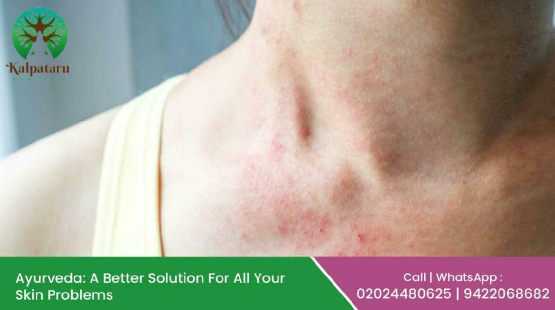 Ayurveda A Better Solution for All Your Skin Problems
