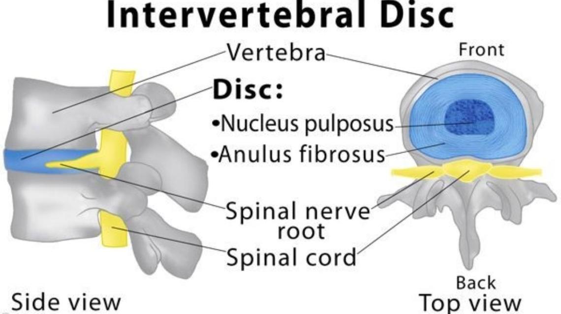 Prolapsed Intervertebral Disc Details Made Easy Specially for You