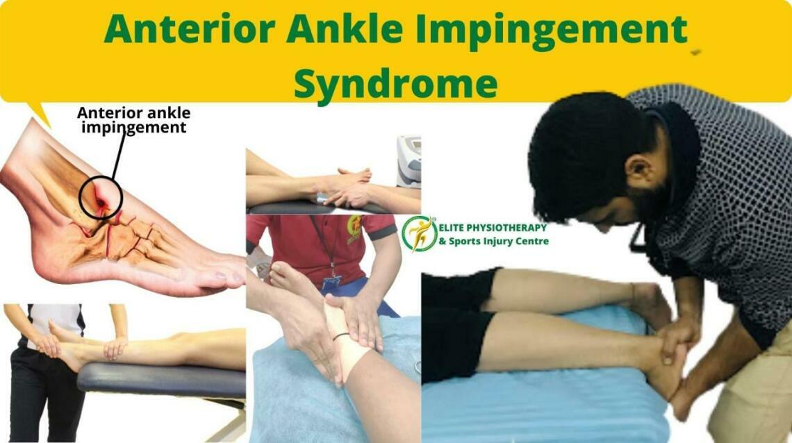 Anterior Ankle Impingement Syndrome