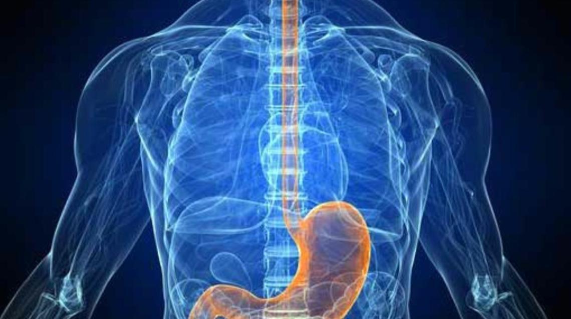 Achalasia Cardia When to See a Surgeon?
