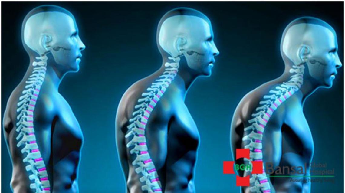 Most Common Causes of Forward Head Posture