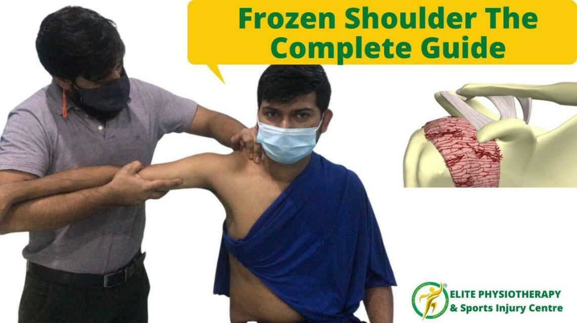Frozen Shoulder the Complete Guide