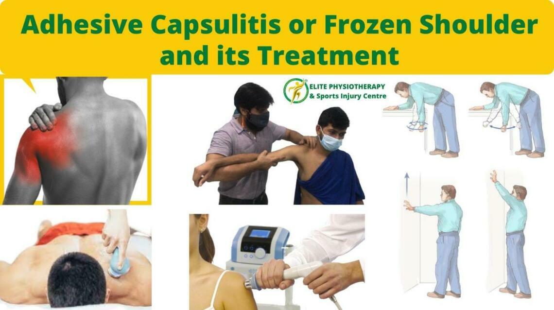 Adhesive Capsulitis or Frozen Shoulder and Its Treatment