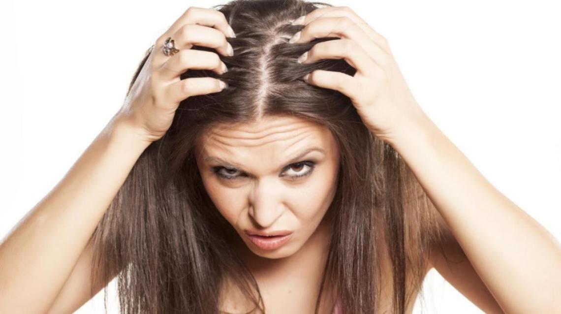 3 Best Ways to Get Rid of Dandruff