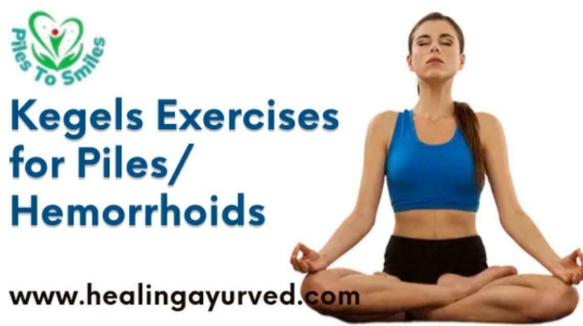Kegel Exercise for Hemorrhoids