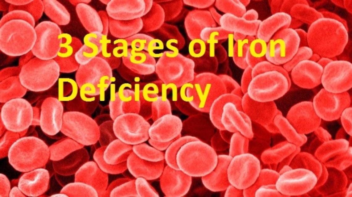 3 Stages of Iron Deficiency