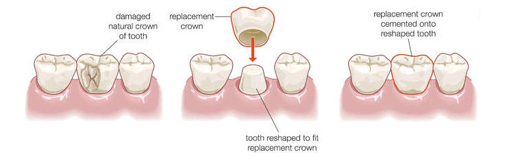 Precision Dental and Dentures of Jay Oklahoma