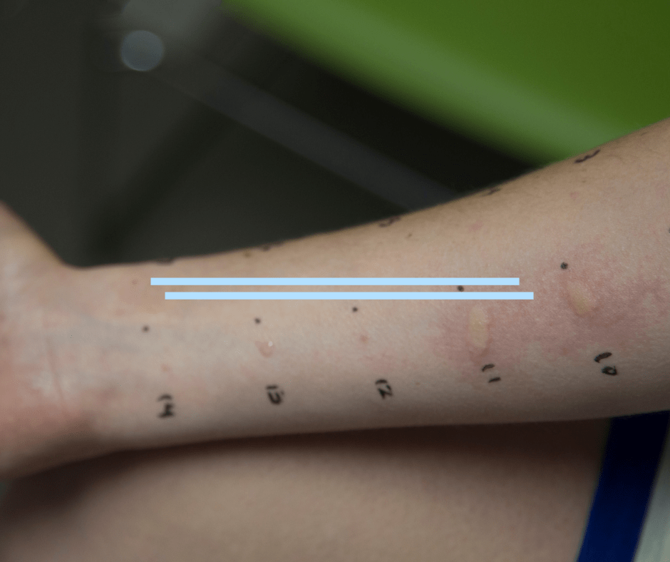 What is a patch test PremierMED