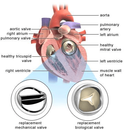 Cardiovascular Surgery - Premier Heart Care Ltd.