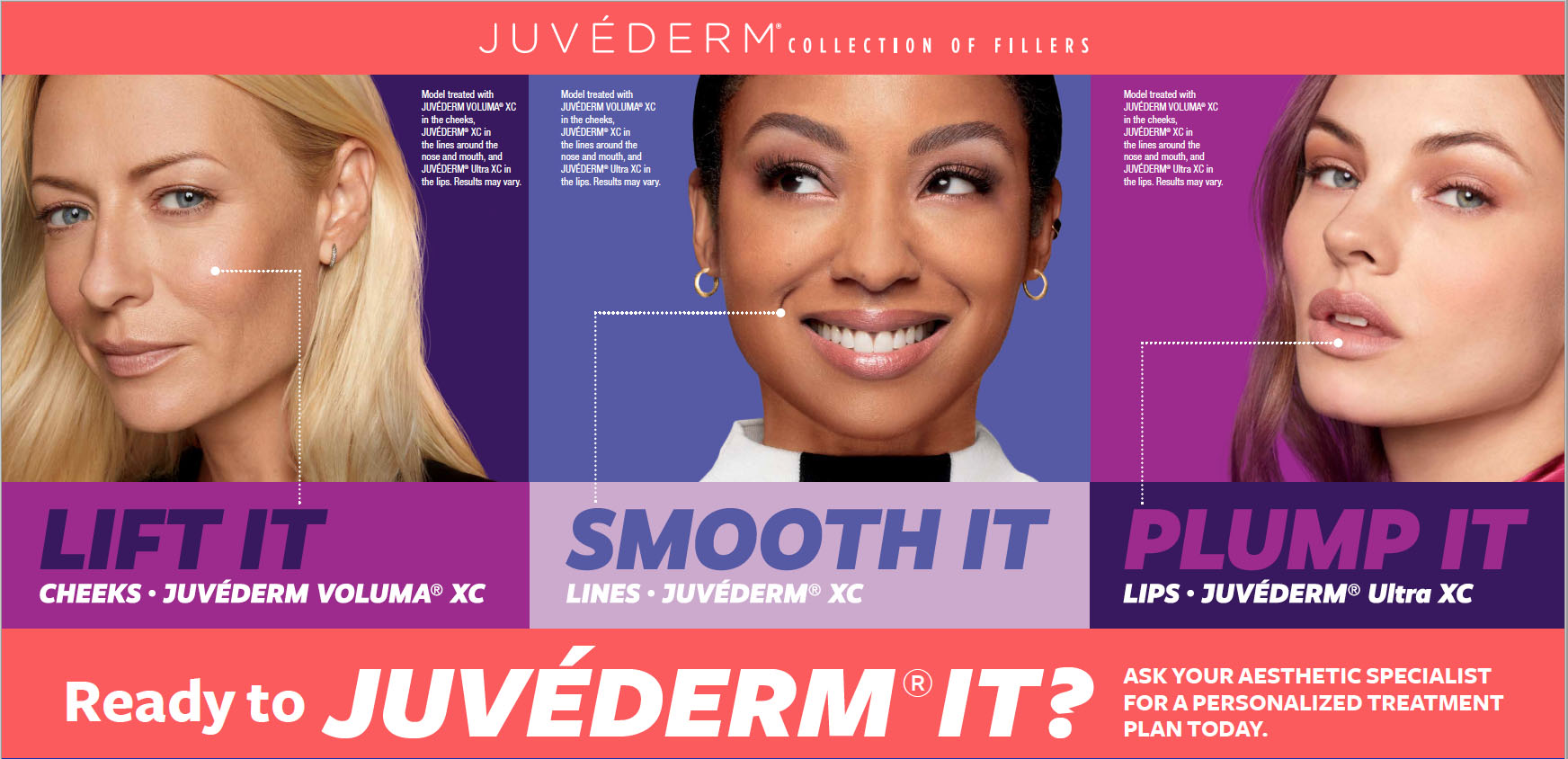 Juvederm Voluma Lips